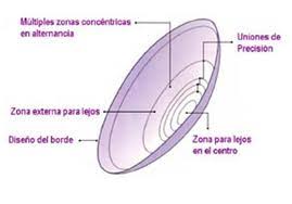 Adaptación Lentillas Progresivas Opiniones | Outlet www.jardimartimoniz.pt